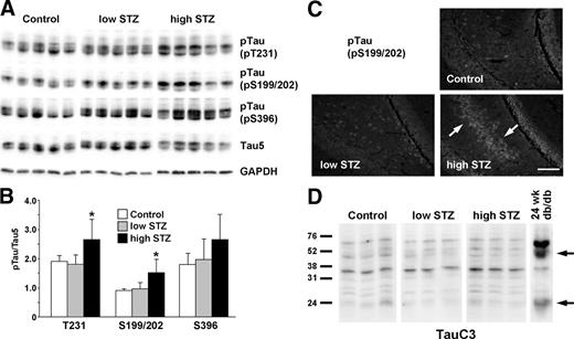 Tau phosphorylation, but not cleavage, is increased in STZ-injected animals. Mice were injected with STZ at 12 wk of age and killed at 24 wk (12 wk diabetes). The low-STZ group received 50 mg/kg STZ for 5 consecutive days, and the high-STZ group received one injection of 150 mg/kg. A, Cortex lysates are immunoblotted for the phosphorylated (pTau) and total tau. B, The densitometric analysis indicates significant increase in tau phosphorylation at pT231 and pS199/202 for the high-STZ group compared with control or low-STZ group. *, P < 0.01. C, Brain slices are stained with antibody against phosphorylated tau at Ser199/202 (pS199/202). Arrows indicate the increased tau staining in high-dose STZ brains. Bar, 50 μm. D, Cortex lysates are immunoblotted with TauC3 antibody to detect cleaved tau (arrows). GAPDH, Glyceraldehyde 3-phosphate dehydrogenase.