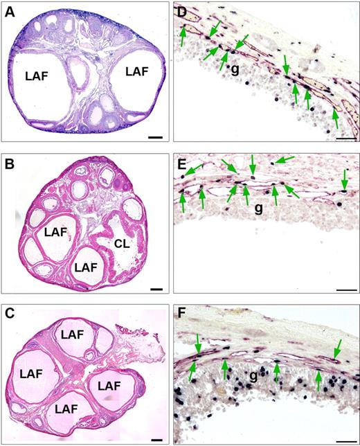 A–C, H&E-stained marmoset ovaries showing that large antral follicles (LAF) can develop despite inhibition of Dll4. A, Ovary from a marmoset on d 10 of the luteal phase after treatment with an antibody to Dll4 on luteal d 0 and d 2. Note the presence of two large antral follicles (LAF), in marked contrast to the restricted follicular growth expected at this stage of the cycle (compare with Fig. 2A). B, Ovary from a control marmoset treated with Fc for the duration of the follicular phase. Note the emergence of three large antral follicles and a recently ovulated follicle (CL). C, Ovary after treatment with Dll4 antibody throughout the follicular phase showing emergence of large antral follicles. D–-F, High-power magnifications of the wall of a large antral follicle in respective ovaries shown in panels A–C dual stained with BrdU (black nuclei) and CD31 (red cytoplasm). Note that the development of the vasculature within the thecal wall, shown by CD31 and the proliferating endothelial cells (shown by green arrows) appears to be similar to the control despite treatment with Dll4 antibody. Proliferating cells (black nuclei) in the granulosa cell layer (g) are also evident in each LAF. Scale bar, 500 μm (A–C) and 50 μm (D–F). CL, Corpus luteum.