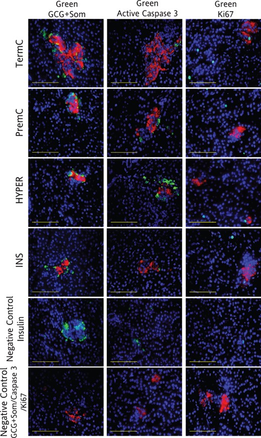 Negative controls are no primary antibody controls for insulin, glucagon plus somatostatin, active caspase 3, and Ki67, respectively. All images have insulin (red, except negative controls) and DAPI (blue). Column 1: green, glucagon (GCG) plus somatostatin (Som); column 2: green, active caspase 3; column 3: green, Ki67. Image magnified ×400. Scale bar, 100 μm.