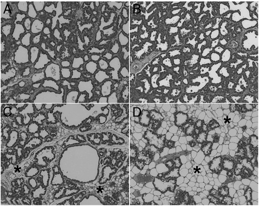 The neutralizing PRLR antibody 005-C04 induced mammary gland involution in lactating dams. Lactating dams remained untreated (A) or were treated with either 10 mg/kg anti-FITC antibody (B) or 10 mg/kg (C) and 30 mg/kg (D) neutralizing PRLR antibody 005-C04 in the IgG2a format as described in Materials and Methods. On postpartal day 11, dams were killed. Representative sections of mammary glands stained with HE are shown at the same magnification. Mammary glands of untreated dams (A) and dams treated with control antibody (B) showed complete alveolar development. Treatment with the neutralizing PRLR antibody 005-C04 (C and D) induced mammary gland involution characterized by alveolar regression and enhanced adipogenesis (asterisks) in a dose-dependent manner. H&E, hematoxylin and eosin
