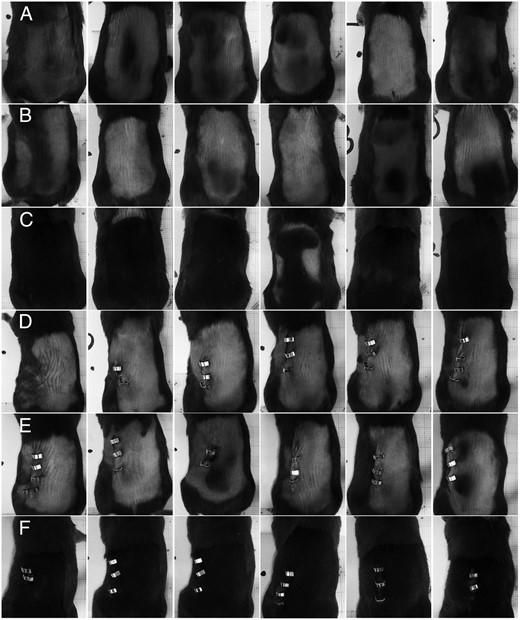 The neutralizing PRLR antibody 005-C04 stimulates hair regrowth in normal and hyperprolactinemic female mice. In this figure, all six animals per treatment group are depicted in a row-wise manner. Eight-week-old female C57BL/6 mice remained either unoperated (rows A–C) or received a pituitary isograft (rows D–F) under their kidney capsule to induce hyperprolactinemia and were shaved on their backs on day 0 (day of grafting). Animals remained untreated (rows A and D) or were treated with either 30 mg/kg control antibody (rows B and E) or specific neutralizing PRLR antibody 005-C04 (rows C and F) on days 0, 7, and 14. Animals were killed and photographed on day 15. Note the pinkish skin color in hyperprolactinemic animals (rows D and E) in comparison with the pink-gray skin color in normoprolactinemic animals (rows A and B), which indicates a delay in hair regrowth in response to hyperprolactinemia. Treatment with the specific neutralizing PRLR antibody 005-C04 accelerates hair regrowth in normal (row C) and hyperprolactinemic animals (row F) if compared with the respective normal (rows A and B) and hyperprolactinemic (rows D and E) controls.