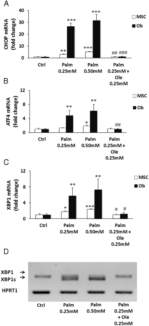 Ole blocked ER stress markers expression and activation of Palm-induced XBP1 splicing. MSC and Ob were treated for 24 hours with 0.25mM Palm ± 0.25mM Ole. C/EBP homologous protein (CHOP) (A), activating transcription factor 4 (ATF4) (B), and XBP1 (C) expression were quantified by qPCR using the ΔΔCT method. Values were normalized for HPRT1 expression and are expressed as the ΔΔCT compared with Ctrl. Results are mean ± SEM of 6 individual experiments. *, P < .05; **, P < .01; ***, P < .001 vs Ctrl; #, P < .05; ##, P < .01; ###, P < .001 vs Palm 0.25mM. D, Representative PCR results for XBP1 splicing, compared with HPRT1 expression, of 1 out of 6 individual experiments in MSC.