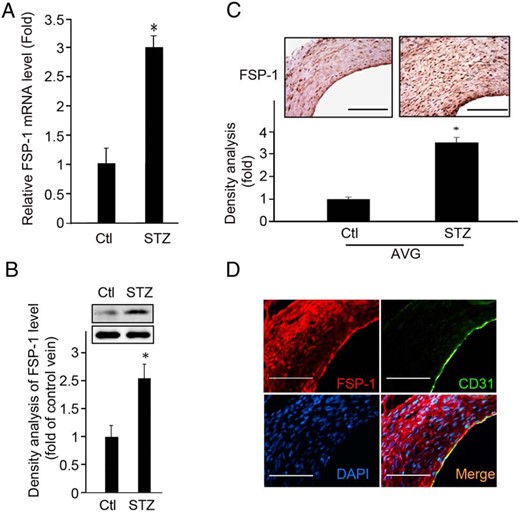 Diabetes increases the expression of FSP-1 in ECs. A and B, mRNA and protein levels of FSP-1 were assessed in AVGs. C, A representative picture of FSP-1 expression in AVGs is shown in the upper panel with the density analysis presented in the lower panel (*, P < .05 vs control, n = 5). D, FSP-1 is expressed in endothelium. Results of double immunostaining of FSP-1 (red) and EC marker, CD31 (green), in AVGs in diabetic mice, are shown. Scale bar in C and D, 100 μm.