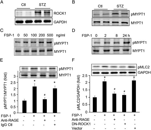 FSP-1 activates ROCK1. A and B, Diabetes enhanced expression and activation of ROCK1 in AVGs. C and D, FSP-1 treatment induced dose- and time-dependent activation of ROCK1 in cultured ECs. E, FSP-1 interacts with RAGE to activate ROCK1 kinase activity. ECs treated with anti-RAGE antibody blocked FSP-1-induced ROCK1 activity. F, FSP-1 induces phosphorylation of MLC2 via the RAGE receptor and ROCK1. ECs were pretreated with RAGE neutralizing antibodies or transfected with dnROCK1 before exposure to FSP-1 for 30 minutes, MLC2 phosphorylation was detected by Western blotting (*, P < .05 vs control; #, P < .05 vs FSP-1-treated group).