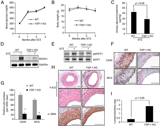 FSP-1 KO suppresses diabetes-induced neointima formation in AVGs. A and B, In mice with STZ-induced diabetes, blood glucose and body weight were measured for 3 months (n = 5 WT and FSP-1 KO mice; *, P < .05, vs control). C, Urinary albumin and creatinine were measured in the WT and FSP-1 KO mice at 3 months after STZ treatment. The ratio of urinary albumin to creatinine was presented (n = 5, P < .05). D and E, FSP-1 KO suppressed ROCK1 expression and activation in AVGs. F and G, FSP-1 KO ameliorates inflammatory cell infiltration in AVGs. AVGs from wild-type or FSP-1 KO diabetic mice were subjected to immunohistochemical staining with antibodies against CD45 and MCA (F). Staining positive cells were counted and summarized in G (*, P < .05, vs wild type; n = 5). H and I, FSP-1 KO suppressed diabetes-induced neointima formation. Representative pictures are presented after H&E and α-SMA immunostaining (mean ± SEM, n = 5; *, P < .05, compared with wild type). Scale bar in F and H, 100 μm.