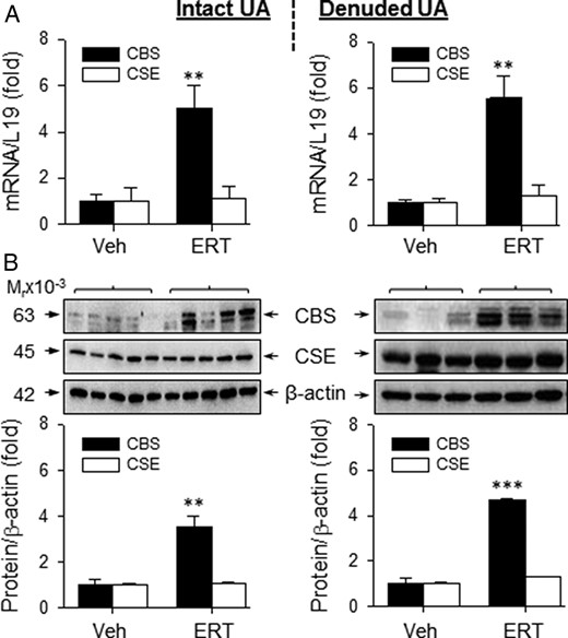 CBS and CSE mRNA and protein expression in UAs from OVX ewes receiving Veh and E2β replacement therapy (ERT) ewes. CBS and CSE mRNAs in intact (top, left) and denuded (top, right) UA. CBS and CSE protein analysis in intact (bottom, left) and denuded (bottom, right) UA. Data (mean ± SEM) are from 3–5 ewes/group. **, P < .01; ***, P < .001 compared with Veh.