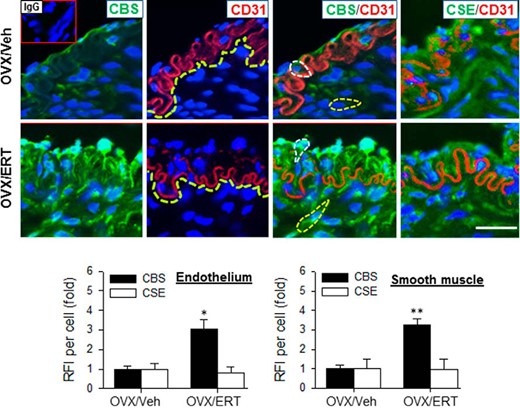 Immunofluorescence localization of CBS and CSE protein in UA from OVX ewes receiving Veh and E2β replacement therapy (ERT). Sections were labeled with specific primary antibodies against CBS (green) or CSE and endothelial cell marker CD31 (red) with nuclei stained with DAPI (blue). Negative control slides were treated similarly but without primary antibodies or with antimouse IgG; no positive staining was detected on these slides (inset of upper left image). Images were analyzed for relative fluorescence intensity (RFI). Representative outlines of cell bodies used for analysis are outlined (left panels) and border of CD31-positive endothelial cells was also indicated (center panels). Data (mean ± SEM) are from 3–5 different ewes/group. *, P < .05; **, P < .01. Scale bar, 50 μm.