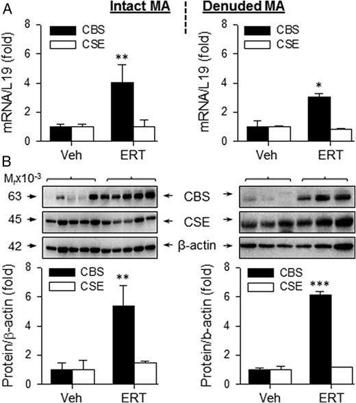 CBS and CSE mRNA and protein expression in MA from OVX ewes receiving Veh and E2β replacement therapy (ERT). Relative mRNA levels of CBS and CSE in intact (top, left) and denuded (top, right) MA. CBS and CSE proteins in intact (bottom, left) and denuded (bottom, right) MA. Data (mean ± SEM) are from 3–5 different ewes/group. *, P < .05; **, P < .01; ***, P < .001.