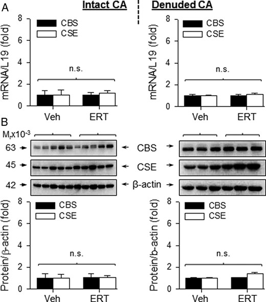 CBS and CSE mRNA and protein expression in CA from OVX ewes receiving Veh and E2β replacement therapy (ERT). Relative mRNA levels of CBS and CSE mRNAs in intact (top, left) and denuded (top, right) CA. CBS and CSE proteins from intact and denuded CA (bottom). ERT did not change CBS or CSE expression. Data (mean ± SEM) are from 3–5 different ewes/group; n.s., not statistically different.