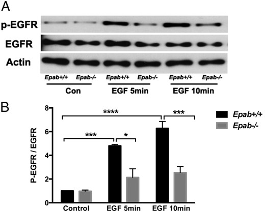 The activation of EGFR is impaired in GCs of Epab−/− mice. A–C, Western blot analysis was performed to compare EGF-induced phosphorylation of EGFR in GCs from WT and Epab−/− mice. GCs were collected from WT and Epab−/− mice at 12 weeks of age after 44–48 hours of 5-IU PMSG injection, cultured, serum starved, and treated with EGF (10 ng/mL) for 5 and 10 minutes. Representative Western blottings are shown in A. The intensity of Western blot bands corresponding to total (T) EGFR (B) and phosphorylated (p) EGFR (C) were analyzed using densitometry. The ratio of p-EGFR to total EGFR was normalized to untreated WT. Data are presented as mean ± SEM from 3 separate experiments. *, significant difference between groups (*, P < .05; ***, P < .001; ***, P < .0001). Significance was determined by two-way ANOVA followed by Tukey's multiple comparisons test.