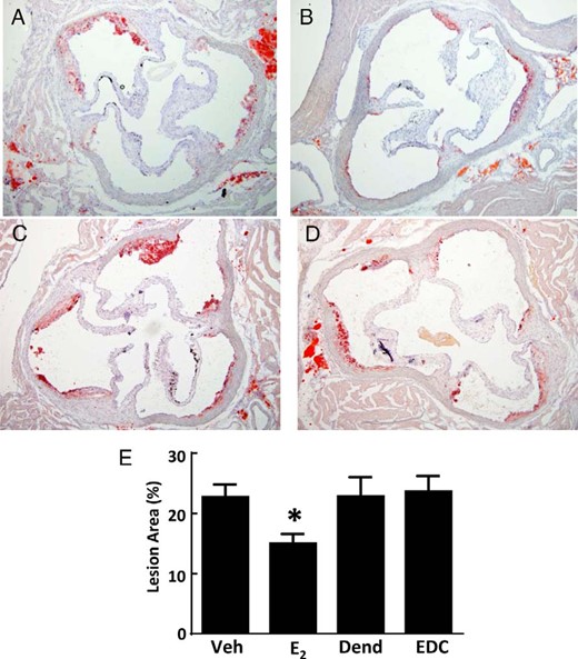 Atherosclerosis in apoE−/− ovariectomized female mice is blunted by E2 but not by EDC. A–D, Representative aortic root sections in ovariectomized female mice treated for 12 weeks with control vehicle (Veh) (A), E2 (B), empty dendrimer control (Dend) (C), or an estrogen equivalent amount of EDC (D) by ip osmotic minipump. E, Summary data for lesion size. Values are mean ± SEM, n = 11–19; *, P < .05 vs vehicle control.