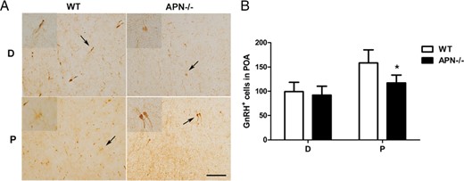Influence of adiponectin deletion on GnRH immunoreactive neurons. A, Representative photographs of GnRH+ cells in POA of WT and APN−/− mice at 4 months of age. Scale bar, 100 μm (low magnification, ×200; high magnification, ×400). B, Bar graphs showed mean ± SEM of GnRH+ cells at D (diestrus) and P (proestrus); *, P < .05, vs WT mice; n = 7, significant differences were determined by t test.