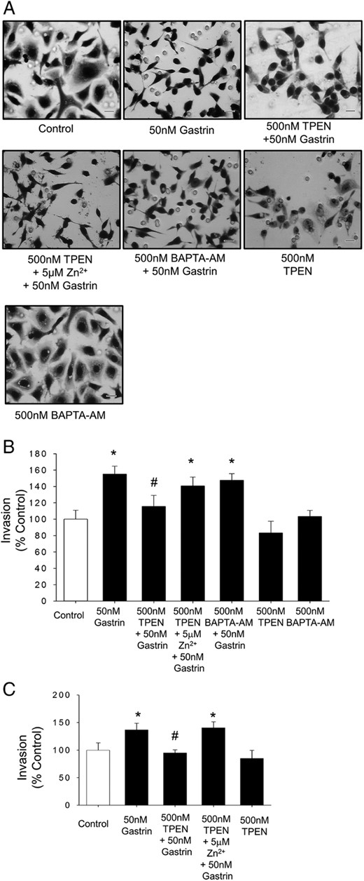 Zinc chelation inhibits gastrin-stimulated migration. A, Morphological changes in AGS-CCK2R cells after the treatment with 10nM gastrin in a Boyden chamber transwell assay in the presence or absence of TPEN or BAPTA-AM. Scale bars, 20 μm. B and C, Migration/invasion of AGS-CCK2R cells (B) or Jurkat cells (C) after treatment with 50nM gastrin in the presence or absence of TPEN was assessed by transwell assay. Values are the mean ± SEM of at least 3 separate experiments and are expressed as a percentage of untreated control cells. *, P < .05 vs control; #, P < .05 vs 50nM gastrin-treated cells.