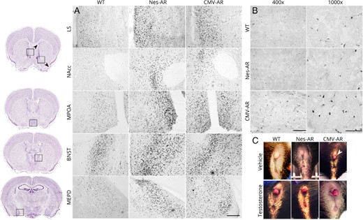 Characterization of AR overexpression models. A, High AR-ir in Nes-AR and CMV-AR male mice compared with WT males in various brain regions (×200 magnification). Scale bar, 200 μm. B, High AR-ir was found in CMV-AR, but not Nes-AR, skeletal muscle compared with WT littermates. Scale bar at ×400 magnification, 100 μm. Scale bar at ×1000 magnification, 50 μm. C, Adult female clitorises after treatment of a vehicle or of testosterone propionate on PND1. Arrow indicates a CMV-AR female with enlarged clitoris after treatment with a vehicle, indicating that the global AR overexpression is functional and sufficient to affect genital development. Image credit, thionin-stained images obtained from the Allen Institute for Brain Science website at www.alleninstitute.org.