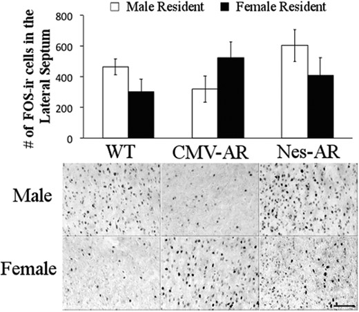 Neural activity in response to male intruder. FOS-ir cells in the lateral septum of male residents (white bars) and female residents (black bars). Ninety minutes before collection of tissue, all experimental mice were exposed to a male intruder for 10 minutes. A significant sex by genotype interaction, such that CMV-AR male mice have a decrease in FOS-ir cells, whereas CMV-AR females have an increase in FOS-ir cells. Scale bar, 100 μm. Error bars, ±SE.