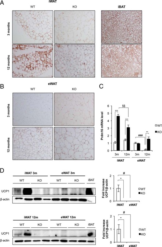 Beiging process in inguinal and epididymal white adipose tissue in BATIGFIRKO mice. A, Immunohistochemistry for Ucp-1 protein (brown stain) in sections of iWAT, iBAT was used as a positive control. B, Immunohistochemistry for Ucp-1 protein in sections of eWAT. All images were taken at magnification, ×20. C, mRNA levels of Prdm16 in iWAT and eWAT at 3 and 12 mo from Igf1r L/L (n = 6 at 3 mo and n = 4 at 12 mo) and BATIGFIRKO (n = 4 at 3 mo and n = 4 at 12 mo) mice respectively. Statistical significance assessed by one-way ANOVA followed by the Bonferroni test. *, P < .05; **, P < .01; ***, P < .001 between WT and KO groups at 3 and 12 months; #, P < .05; ##, P < .01; ###, P < .001 between WT groups; and §, P < .05; §§, P < .01; §§§, P < .001 between KO groups. D, Representative blots from UCP-1 protein expression in iWAT and eWAT (45 μg) at 3 and 12 mo and its corresponding quantitation (n = 3–4 per group). In both blots 8 μg of iBAT at 3 or 12 mo were used as a positive control of UCP-1 protein expression. Statistical significance assessed by Kruskall Wallis and Mann-Whitney U test after testing normality condition by one sample Kolmogorov-Smirnov test, *, P < .05; **, P < .01; ***, P < .001 between WT and KO groups at 3 and 12 mo; #, P < .05; ##, P < .01; ###, P < .001 between WT groups.