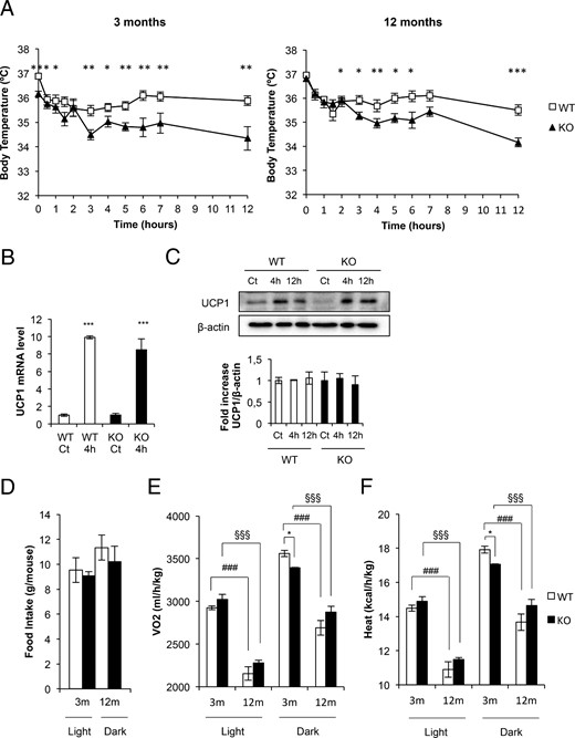 Cold acclimation and energy expenditure in BATIGFIRKO and (WT) mice. A, Representative plots of cold-exposure analysis showing the temperature from 0 to 12 h comparing Igf1r L/L (n = 8 at 3 mo and n = 5 at 12 mo) and BATIGFIRKO (n = 6 at 3 mo and n = 11 at 12 mo) mice at 3 mo (left plot) and 12 mo (right plot). B, Ucp-1 mRNA levels detected by q-PCR after 4 h of cold-exposure comparing 3-month-old Igf1r L/L (n = 4) and BATIGFIRKO (n = 4) mice. C, Comparison of UCP-1 protein levels at 4 and 12 h of cold exposure and its corresponding quantitation comparing 3-month-old Igf1r L/L (n = 4) and BATIGFIRKO (n = 4) mice. Statistical significance assessed by two-tailed Student t test. *, P < .05; **, P < .01; ***, P < .001 between WT and KO groups at 3 and 12 mo. D, Daily food intake under standard diet; E,VO2; and F, heat production were measured comparing Igf1r L/L (n = 4 at 3 mo and n = 4 at 12 mo) and BATIGFIRKO (n = 4 at 3 mo and n = 4 at 12 mo) mice. Mice were housed individually and all measurements were taken every 10 minutes during 72 h. Statistical significance assessed by one-way ANOVA followed by the Bonferroni test. *, P < .05; **, P < .01; ***, P < .001 between WT and KO groups at 3 and 12 mo; #, P < .05; ##, P < .01; ###, P < .001 between WT groups; and §, P < .05; §§, P < .01; §§§, P < .001 between KO groups, respectively.