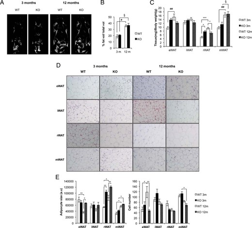 The adipose organ in BATIGFIRKO mice. A, Representative images from NMR comparing Igf1r L/L and BATIGFIRKO mice at 3 and 12 mo. B, Graph representing the percentage of fat volume per total volume at 3 and 12 mo in Igf1r L/L (n = 4 at 3 mo and n = 4 at 12 mo) and BATIGFIRKO (n = 4 at 3 mo and n = 4 at 12 mo) mice. C, Graph representing the eWAT, iWAT, rWAT and mWAT weights per total body weight comparing Igf1r L/L (n = 12) and BATIGFIRKO (n = 13) mice at 3 and 12 mo, respectively. D, Adipocyte size from eWAT, iWAT, rWAT, and mWAT compartments are shown comparing Igf1r L/L (n = 5) and BATIGFIRKO (n = 5) mice from 3 and 12 mo (n = 250 adipocytes per group) at magnification, ×20. The corresponding quantitation is presented below. E, Adipocyte number quantification from eWAT, iWAT, rWAT, and mWAT compartments comparing Igf1r L/L (n = 5) and BATIGFIRKO (n = 5) mice at 3 and 12 mo, respectively. Statistical significance assessed by one-way ANOVA followed by the Bonferroni test. *, P < .05; **, P < .01; ***, P < .001 between WT and KO groups at 3 and 12 mo; #, P < .05; ##, P < .01; ###, P < .001 between WT groups; and §, P < .05; §§, P < .01; §§§, P < .001 between KO groups, respectively.