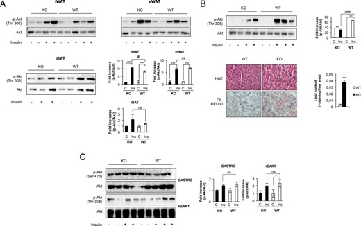 Insulin sensitivity in major insulin target tissues. A, After 1 U/kg body weight of human insulin injection, insulin signaling was measured in iWAT and eWAT and iBAT compartments at 12 mo of age comparing Igf1r L/L (iWAT and eWAT n = 5; iBAT n = 4) and BATIGFIRKO (iWAT and eWAT n = 4; iBAT n = 3) mice. The corresponding quantitation is presented below indicating the fold-increase of phospho-Akt/Akt. B, Representative blots from insulin signaling experiments in liver of 12 mo of age in Igf1r L/L (n = 5) and BATIGFIRKO (n = 4) and its corresponding quantitation indicating the fold-increase observed in the ratio phospho-Akt/Akt (upper panel). Representative hematoxylin-eosin and Oil-red O staining from liver of 12 months of age in WT (n = 5) and BATIGFIRKO (n = 4) mice and its corresponding quantitation is presented below. Magnification, ×20 (botton panel). Statistical significance assessed by two-tailed Student t test. *, P < .05; and **, P < .01; and ***, P < .001 between WT and IGF1R KO. C, Representative blots from insulin signaling experiments in gastrocnemius muscle and heart of 12 mo of age in Igf1r L/L (n = 5) and BATIGFIRKO (n = 4). It is represented in the corresponding plots the fold-increase observed in the ratio phospho-Akt/Akt. Statistical significance assessed by one-way ANOVA followed by the Bonferroni test. *, P < .05; **, P < .01; and ***, P < .001 between WT and KO in control vs insulin; #, P < .05; ##, P < .01; and ###, P < .001 comparing insulin from WT vs KO.