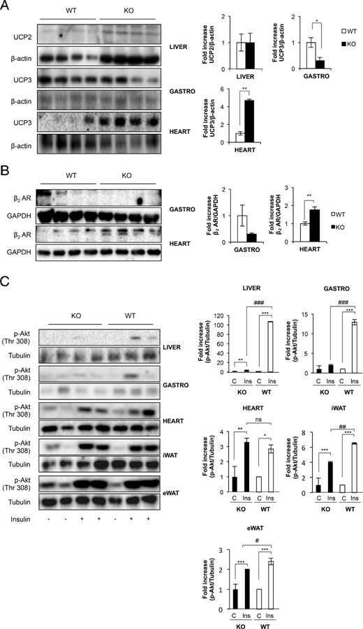 Protective effect of UCPs on insulin-target tissues against exogenous lipid insult. A, Representative blots from UCP-2 (in liver) and UCP-3 (in gastrocnemius muscle and heart) protein levels observed comparing Igf1r L/L (n = 4) and BATIGFIRKO (n = 4) mice from age 12 mo. The corresponding quantitation is presented below indicating the fold-increase of UCP-2 or UCP-3/β-actin. B, Representative blots from β2 adrenergic receptors in gastrocnemius muscle and heart of 12 months of age comparing Igf1r L/L (n = 4) and BATIGFIRKO (n = 4) mice. Statistical significance assessed by two-tailed Student t test. *, P < .05; **, P < .01; ***, P < .001 between WT and KO groups, respectively. C, Insulin signaling in liver, gastrocnemius muscle, heart, iWAT and eWAT in Igf1r L/L (n = 3) and BATIGFIRKO (n = 4) upon 16 wk of HFD. It is represented in the corresponding plots the fold-increase observed in the ratio phospho-Akt/α-tubulin. Statistical significance assessed by one-way ANOVA followed by the Bonferroni test. *, P < .05; **, P < .01; and ***, P < .001 between WT and KO in control vs insulin; #, P < .05; ##, P < .01; and ###, P < .001 comparing insulin from WT vs KO, respectively.