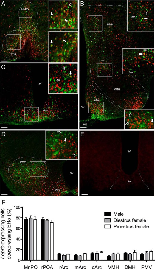 Extensive hypothalamic ERα coexpression with LepRb is limited to the preoptic region in male and female mice. Representative examples of ERα immunoreactivity (red nuclear staining) and LepRb-Cre-GFP (green cytosol and fiber staining) in the rPOA and MnPO (A), DMH, VMH, and medial arcuate nucleus (mArc) (B), rostral arcuate nucleus (rArc) (C), and the caudal arcuate nucleus (cArc) and ventral premammilary nucleus (PMV) (D) are shown. Within each panel, the boxed regions are enlarged on the left. Filled arrows indicate colocalized cells; unfilled arrows indicate noncolocalized LepRb-Cre-GFP cells. E, Absence of staining in neuronal ERα KO mouse tissue. Scale bars, 50 μm. ME, median eminence; 3V, third ventricle. F, Percentage of LepRb-Cre-GFP cells that coexpress ERα within each region in male, diestrous females, and proestrous females (n = 5 per group). Error bars denote SEM.