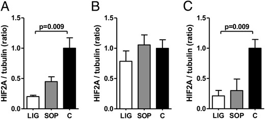 Densitometric ratios of HIF-2α (HIF2A) protein expression and tubulin protein expression (tubulin served as loading control) in the fetal liver of groups LIG, SOP, and C on gestational day E19 (A), E20 (B), and E22 (C). Tissue samples were derived from the livers of fetuses in uterine position 2 (second most caudal position). C, fetuses of unoperated control dams; LIG, fetuses of dams with bilateral ligation of uterine arteries and veins; SOP, fetuses of sham-operated dams. LIG, E19, n = 5; SOP, E19, n = 6; C, E19, n = 3; LIG, E20, n = 7; SOP, E20, n = 5; C, E20, n = 3; LIG, E22, n = 5; SOP, E22, n = 5; C, E22, n = 6. Data are shown as mean ± SEM. Significant differences are indicated by the P value. One outlier was identified by Grubb's test in group SOP on day E22 (C) and excluded. For Western blots, see Supplemental Figure 3.