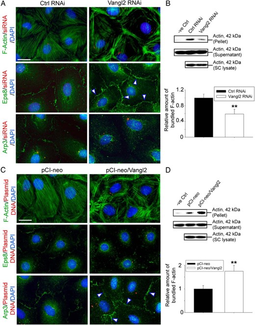 Changes in F-actin organization in Sertoli cells after Vangl2 KD vs overexpression are mediated through Eps8 and Arp3. F-actin was visualized using fluorescein isothiocyanate-conjugated phalloidin (green fluorescence) in Sertoli cells on day 5 or day 4 after transfection of siRNA duplexes or plasmid DNA containing Vangl2 full-length cDNA as noted in the legend to Figures 3 and 4, respectively. A, KD of Vangl2 led to the reorganization of F-actin in which microfilaments were better aligned at cell cortical zone vs control cells, thereby strengthening the Sertoli cell TJ-permeability barrier function as noted in Figure 3. This is mediated by a shift in the spatiotemporal expression of actin barded-end capping and bundling protein Eps8 and branched actin nucleation protein Arp3, in which Eps8 was more predominant at the cell-cell interface (see white arrowheads), along with a considerably reduced Arp3 localization at the cell cortical zone but more into the cell cytosol. Scale bar, 15 μm, which applies to other micrographs. B, These results are also supported by biochemical assay that monitored the overall actin bundling activity in lysates of Sertoli cells, in which fewer actin bundles were found in these cells after Vangl2 KD because they were mostly shifted to the cell cortical zone to support the barrier function. Free actin filaments were found in supernatant, whereas bundled F-actin was concentrated in the pellet. Rabbit muscle actin incubated with only lysis buffer served as a negative control (see Materials and Methods for details). Each bar in the bottom panel of B is a mean ± SD of three experiments, and each experiment had triplicate dishes for the bundling assay. **, P < .01 by Student's t test. C, Overexpression of Vangl2 in Sertoli cells led to the reorganization of F-actin in which microfilaments became more truncated, and a considerably reduced number of long stretches of actin microfilaments was found at the cell cortical zones, thereby destabilizing cell adhesion proteins to support the Sertoli cell TJ-permeability barrier function as noted in Figure 4. These changes appeared to be mediated through a shift in the spatiotemporal expression of Eps8 and Arp3 in which Eps8 at the cell-cell interface was considerably reduced, but more Arp3 was found at the cell cortical zone (see white arrowheads). Scale bar, 15 μm, which applies to other micrographs. D, An increase in actin bundling activity was detected in lysates of Sertoli cells after overexpression of Vangl2, likely due to an increase in branched actin polymerization activity mediated by the Arp2/3 complex. In this context, it is of interest to note that the goat antihuman actin antibody used in our study (Table 1) cross-reacted with α-, β- and γ-actin in rats and rabbits; however, actin found in rat Sertoli cells is predominantly β-actin, whereas actin found in the rabbit skeletal muscle supplied in the kit is predominantly α-actin; as such, the bands shown in panels B and D were a combination of α- and β-actin, and this biochemical assay semiquantitatively assessed the ability of Sertoli cell (SC) lysates after KO and overexpression of Vangl2 to bundle α-actin supplied in the kit. Each bar is a mean ± SD of three experiments, and each experiment had triplicate dishes for the bundling assay. **, P < 0.01 by Student's t test.