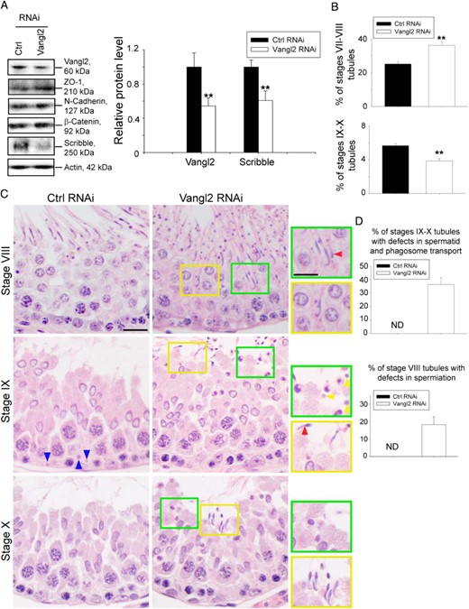 KD of Vangl2 in vivo affects germ cell and phagosome transport. Adult rats received intratesticular injections of Vangl2-specific siRNA duplexes vs nontargeting negative control siRNA duplexes for Vangl2 KD. Six rats were euthanized by CO2 asphyxiation 3 days after the last transfection, and testes were removed for experiments. A, Immunoblotting using lysates of testes, illustrating the KD of Vangl2 had no off-target effects on other BTB-associated proteins except a down-regulation of Scribble, consistent with in vitro studies shown in Figure 3. Histogram on the right panel summarizes the immunoblotting results. Each bar is a mean ± SD of three rat testes. **, P < .01 by Student's t test. B, Defects in spermatogenesis were noted in which the frequency (percentage) of stages VII–VIII and IX–X tubules was increased and decreased, respectively, due to defects in spermatid transport. The percentage of VII–VIII and IX–X tubules found in the control rat testes was consistent with results of an earlier report (67). C, Hematoxylin and eosin staining of paraffin sections of testes. Whereas elongated spermatids near the lumen edge were induced to undergo spermiation in stage VI–VII tubules, spermatids that were found deep inside the adluminal compartment of the epithelium failed to be transported to the luminal edge because step 19 spermatids were persistently found trapped inside the epithelium as noted in stage VIII tubules, and some of these spermatids had defects in polarity in which their heads were pointing 90°-180° away from the basement membrane (see red arrowhead). Step 19 spermatids remained to be seen in stage IX and even X tubules when step 9 and 10 spermatids were developed in IX and X tubules, respectively. Also, phagosomes that should have been transported to the base of the epithelium in stage IX tubules (see blue arrowheads in control testes) as reported (50) were also found near the luminal edge (see yellow arrowheads in green boxed area), illustrating defects in phagosome transport, and defects in polarity were also noted (see red arrowhead). Some areas were boxed in yellow or green and magnified and shown on the right panel. Scale bar, 15 μm; scale bar in inset, 15 μm, which applies to other micrographs and insets. D, Histogram summarizing results of stages IX-X tubules and stage VIII tubules with defects vs control testes. ND, not detectable. Each bar is a mean ± SD of three rat testes.