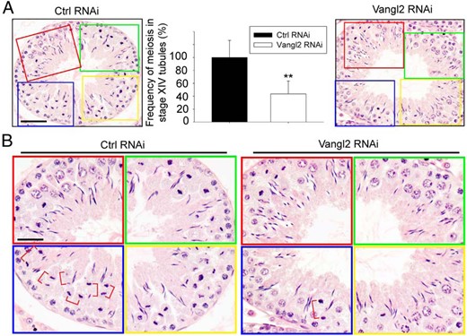 KD of Vangl2 in vivo perturbs meiosis. Effects of Vangl2 KD on meiosis were monitored by scoring the frequency of meiosis in stage XIV tubules. A, Control rat testes transfected with nontargeting control siRNA duplexes had approximately 30 meiotic cells as shown in the boxed areas of red, green, blue, and yellow, which were enlarged and shown in the bottom panel. Vanlg2 KD reduced this frequency by at least 60%, as noted in the right panel, and these findings were summarized in the bar graph shown in the middle panel. Each bar is a mean ± SD of three rats. **, P < .05 by Student's t test. Scale bar, 80 μm, which applies to the other micrograph. B, Magnified images of the boxed colored areas shown in panel A, depicting the frequencies of meiosis. Meiotic cells at the anaphase or telophase were noted in red brackets. Scale bar, 50 μm, which applies to other micrographs.