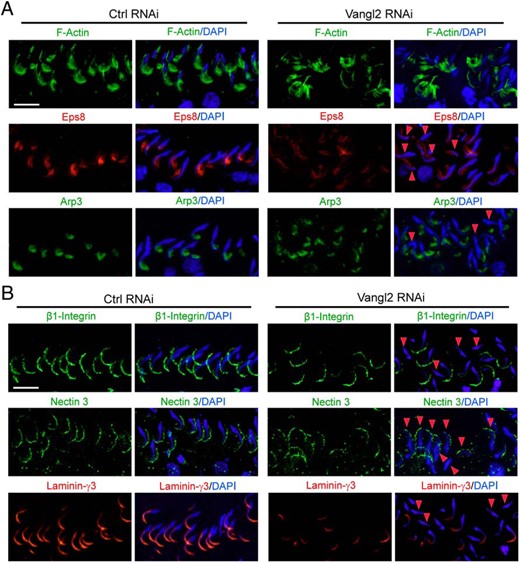 Vangl2 KD in the testis in vivo alters actin organization at the apical ES via changes in the spatiotemporal expression of Eps8 and Arp3 that impedes adhesion protein localization, impairing spermatid polarity and adhesion. A, Vangl2 KD by RNAi caused a disoganization of F-actin (green) at the apical ES, in which F-actin no longer expressed abundantly near the tip and the concave (ventral) side of the spermatid head, resulting from changes in the spatiotemporal expression of Eps8 (red) and Arp3 (green). In spermatids that had defects in polarity (see red arrowheads) in which their heads no longer pointed toward the basement membrane but deviated by at least 90° away from the intended orientation, considerably reduced Eps8 and/or Arp3 was detected. Scale bar, 50 μm, which applies to other micrographs. B, Changes in the F-actin organization led to changes in the distribution of apical ES adhesion proteins β1-Integrin (green, specific to Sertoli cells), nectin-3 (green, specific to spermatids), and laminin-γ3 chain (red, specific to spermatids) because these proteins use F-actin for attachment. It was noted that these apical ES adhesion proteins no longer tightly associated with apical ES but considerably diminished in particular in spermatids displaying defects in polarity (see red arrowheads). Scale bar, 50 μm, which applies to other micrographs.