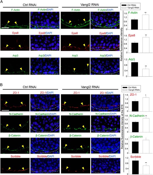 Vangl2 KD in the testis in vivo impedes BTB dynamics. A, Vangl2 KD in the testis in vivo led to a persistent presence of F-actin in stage VIII tubules when F-actin should have been transiently reduced to facilitate the transport of preleptotene spermatocytes across the BTB (annotated by yellow arrowheads) as seen in control testes. The basement membrane, adjacent to the BTB, is annotated by a dashed white line. These changes in F-actin organization was supported by an alteration on the spatiotemporal expression of Eps8 and Arp3 at the site, which included a persistent presence of Eps8, but a concomitant disappearance of Apr3 so that actin microfilaments remained in a bundled configuration conferred by Eps8. Scale bar, 60 μm, which applies to other micrographs. Histograms on the right panel are a summary of the data shown in the left panel. Each bar is a mean ± SD of three rats. **, P < .01 by Student's t test. B, The persistent presence of F-actin at the BTB thus supported the recruitment of ZO-1 and N-cadherin, but not β-catenin, to the BTB (annotated by yellow arrowheads), and the basement membrane is annotated by a dashed white line. Also, a down-regulation of Scribble at the BTB was noted, consistent with earlier findings based on a KD of Scribble polarity complex module in the rat testis (23). Scale bar, 60 μm, which applies to other micrographs. Histograms on the right panel are a summary of the data shown in the left panel. Each bar is a mean ± SD of three rats. *, P < .05, **, P < .01 by Student's t test.