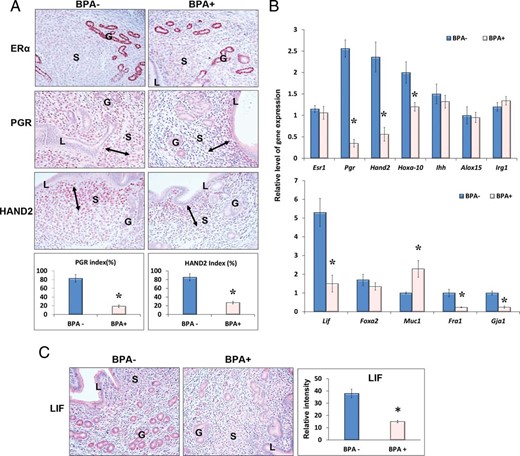 Chronic exposure to BPA impairs ERα- and PGR-mediated signaling at the time of embryo implantation. Prepubertal female mice were exposed to 60 μg/kg · d of BPA (BPA+) or vehicle control (BPA−) and subjected to the delayed implantation mouse model as described above. Uterine tissues were collected at 12 hours after E2 administration. A, Uterine sections were subjected to IHC analysis using antibodies against ERα, PGR, and HAND2. B, Total RNA was purified from BPA-exposed and unexposed uterine tissues and subjected to qPCR using primers specific for Esr1, Pgr, Hand2, Hoxa10, Ihh, Alox15, and Irg1 (upper panel) and Lif, Foxa2, Muc1, Fra1, and Gja1 (lower panel). 36b4 or Krt18 was used as internal controls. C, Uterine sections were subjected to IHC analysis using an antibody against LIF. Representative images in each treatment group are shown. The percentages of the immunostaining positive cells for PGR and HAND2 in the indicated areas (left and right arrows) and the relative intensities of LIF staining were analyzed by ImageJ software. The values represent mean ± SEM of 3 independent samples (n = 3). L, G, and S denote luminal epithelium, glandular epithelium, and stroma, respectively. Asterisks indicate significant difference from the control group; *, P < .01.