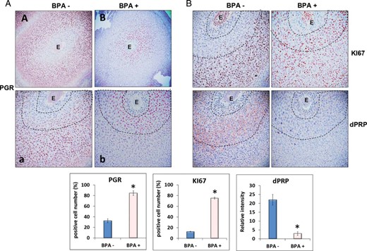 Chronic BPA affects uterine stromal cell proliferation and differentiation during decidualization. Female mice exposed to 60 μg/kg · d of BPA (BPA+) or vehicle control (BPA−) were subjected to the delayed-implantation mouse protocol as indicated in Figure 1. Uterine sections were collected at 48 hours after E2 administration and subjected to IHC analysis using antibodies against PGR (A), KI67 or dPRP (B), respectively. Panels a and b in A are magnified images of A and B, respectively. Representative images in each treatment group are shown. The percentages of the immunostaining positive cells for PGR and KI67 in the indicated areas and the relative intensities of dPRP staining (within dash lines) were analyzed by ImageJ software. The values represent mean ± SEM of 3 independent samples (n = 3). E, embryo.