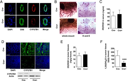 Cre-mediated ME-targeted ablation of the Cyp27b1 gene in PyMT-MMTV mice reduces tumor 1,25(OH)2D concentrations but does not affect normal mammary development. A, IF staining of CYP27B1 in normal ME of PyMT-MMTV mice; control mice (Cre−) (top) and Cyp27b1-ablated mice (Cre+) (bottom). CK8 staining for luminal cells (green), CYP27B1 staining (red), and DAPI (blue). B, Whole-mount staining of mammary glands: neutral red (left) and H and E (right). Cre− (control, top) and Cre+ (Cyp27b1-ablated, bottom) at 4 weeks. C, 25(OH) levels in serum at 11 weeks (Cre− n = 25, Cre+ n = 28, P = .128). D, IF staining of CYP27B1 in mammary tumors at 11 weeks; control mice (Cre−) (top) and Cyp27b1-ablated mice (Cre+) (bottom). Below, Western blotting for CYP27B1 (representative of 6 animals). E, 25(OH) levels in mammary tumors (Cre− n = 25, Cre+ n = 28; P = .136). F, 1,25(OH)2D levels in tumors from control (Cre−) and Cyp27b1-ablated (Cre+) animals (Cre− n = 25, Cre+ n = 28; ***, P < .0001). Scale bars, 50 μm (A and D) and 5 μm (B).