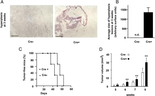 Ablation of Cyp27b1 gene in PyMT-MMTV mice accelerates early stages of mammary tumorigenesis in vivo. A, H and E staining of mammary tissue at 3 weeks in control (Cre−) and Cyp27b1-ablated (Cre+) animals. B, Quantification of hyperplasia surface in control (Cre−) and Cyp27b1-ablated mice (Cre+) (n = 11/group), n.d., not detectable. C, Kaplan-Meier curve (log rank test) for appearance of palpable mammary tumors in control (Cre−, n = 37) or ablated (Cre+, n = 18) mice (P = .034). All (100%) mice are affected. D, Comparison of tumor volumes in control (Cre−) and Cyp27b1-ablated (Cre+) animals at killing; n = 30/group; **, P < .01.