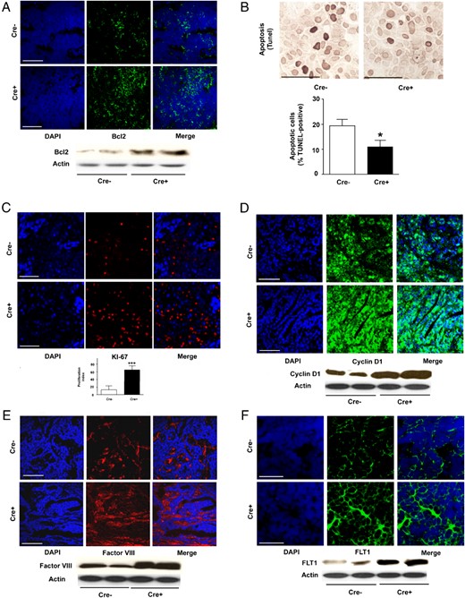 Cyp27b1 ablation in ME modifies apoptosis, proliferation, cell cycle, and angiogenesis markers in mammary tumor tissue. A, IF staining for Bcl2 apoptosis regulator in (below) Western blotting. B, TUNEL staining for apoptosis and quantification histogram (n = 7 in each group; *, P = .045). C, IF staining of KI-67 proliferation marker. Below, Quantification. D, IF staining for cyclin D1 cell division. Below, Western blotting. E, IF staining for factor VIII angiogenesis marker. Below, Western blotting. F, IF staining for FLT1 angiogenesis marker. Below, Western blotting. All Western blottings illustrate a selection from 6 mice. For all, Cre− are control and Cre+ are Cyp27b1-ablated animals. Scale bars, 50 μm (A and C–F) and 200 μm (B).