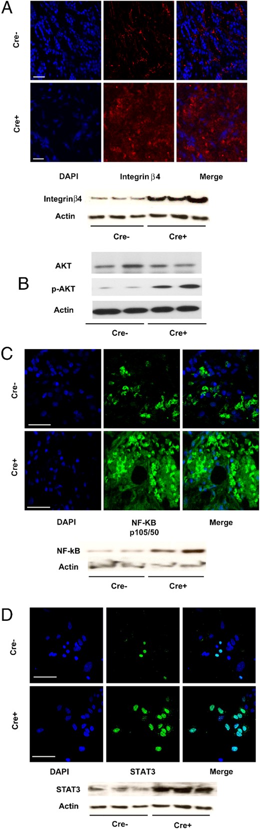 Cyp27b1 ablation increases expression of integrin and NF-κB-related signaling molecules. A, IF staining for integrin β4. Below, Western blotting. B, Western blottings for AKT whole protein, and serine 473 phosphorylation levels in tumor tissue. C, IF staining for NF-κB p105/p50 transcription factor in tumor tissue. Below, Western blotting. D, IF staining for STAT3 transcription factor. Below, Western blotting. All Western blottings illustrate a selection from 6 mice. For all, Cre− are control and Cre+ are Cyp27b1-ablated animals. Scale bars, 50 μm (A, C, and D).