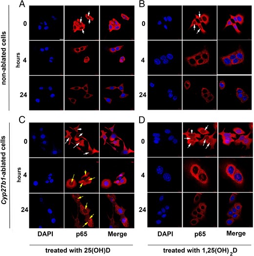 NF-κB p65 is sequestered in the cytoplasm of tumor cells if active 1,25(OH)2D is externally provided or locally synthesized from exogenous 25(OH)D. IF staining pattern (blue, DAPI; red, p65) of nonablated (A and B) and Cyp27b1-ablated (C and D) in vitro cultured tumor cells treated for 0, 4, or 24 hours with 10−7M 25(OH)D (A and C) or 1,25(OH)2D (B and D). White arrows, nuclear p65 at T0. Yellow arrows, remaining nuclear p65 after 25(OH)D treatment. Scale bar, 50 μm.