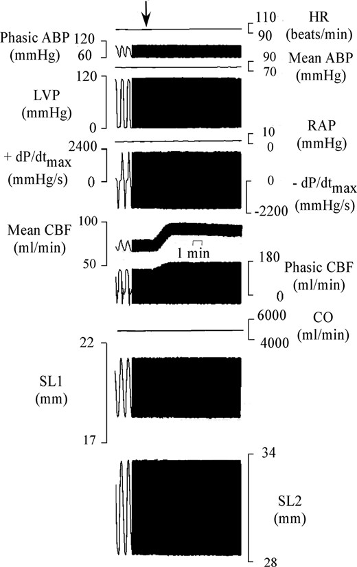 Example of experimental recording taken in 1 of the 20 pigs. From top to bottom are shown heart rate (HR), phasic and mean aortic BP (ABP), LV pressure (LVP), right atrial pressure (RAP), maximum rate of change of left systolic ventricular pressure (+dP/dtmax), minimum rate of change of left systolic ventricular pressure (−dP/dtmax), mean and phasic coronary blood flow (CBF), cardiac output (CO), and segment length (SL1 and SL2). The arrow indicates the start of des-acyl ghrelin infusion at 100 pmol/mL measured coronary blood flow.