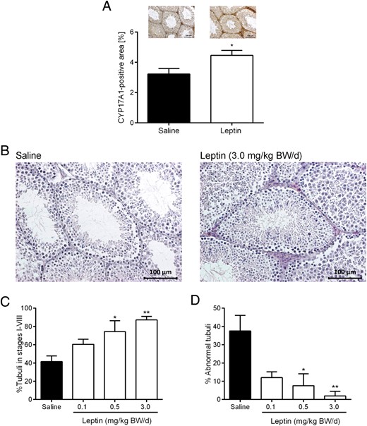 Testicular CYP17A1 protein synthesis (A), hematoxylin and eosin-stained testis sections (B), percent tubules in stages I–VIII (containing all spermatogenic stages including spermatogonia, spermatocytes, round spermatids, and elongated spermatids) (C), and percent abnormal tubules, defined as tubules undergoing spermatogenic arrests (D): 1) premeiotic arrest (only spermatogonia), 2) meiotic arrest (no round or elongated spermatids), or 3) postmeiotic arrest (no elongated spermatids present) in ob/ob mice treated with saline or leptin over 12 weeks. Data are presented as mean ± SE and represent n ≥ 4 per group. Representative images are shown in A and B; *, P < .05; **, P < .01 compared with saline.