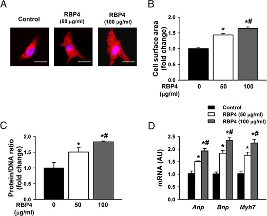 RBP4 induces hypertrophic responses in primary cardiomyocytes. A–D, Cardiomyocytes were treated with recombinant mouse RBP4 or vehicle control for 48 hours. Hypertrophy was assessed by cell size (A), cell surface area measurement (B), protein to DNA ratio (C), and analysis of the mRNA expression for Anp, Bnp, and Myh7 by qRT-PCR (D) (n = 6 per group). *, P < .05 vs control; #, P < .05 vs RBP4 with 50 μg/mL. Bar, 20 μm. AU, arbitrary units.