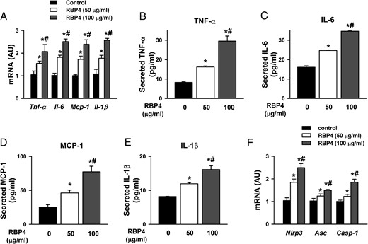 RBP4 promotes inflammation in primary cardiomyocytes. A, mRNA expression levels of Tnf-α, Il-6, Mcp-1, and Il-1β. B–E, Secretion of TNF-α, IL-6, MCP-1, and IL-1β protein in the supernatant of cultured cardiomyocytes. F, mRNA expression of the components of NLRP3 inflammasome (n = 6 per group). *, P < .05 vs control; #, P < .05 vs RBP4 with 50 μg/mL. AU, arbitrary units.