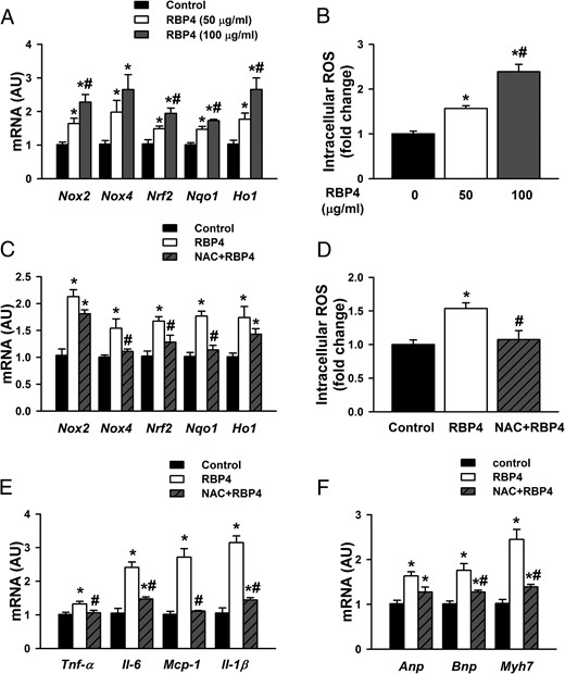 RBP4 enhances oxidative stress in primary cardiomyocytes. A and B, Cardiomyocytes were treated with recombinant mouse RBP4 or vehicle control for 48 hours. Oxidative stress was assessed by mRNA expression of Nox2, Nox4, Nrf2, Nqo1, and Ho1 (A) and intracellular ROS production (B) (n = 6 per group). *, P < .05 vs control; #, P < .05 vs RBP4 with 50 μg/mL. C–F, Cardiomyocytes were pretreated with antioxidant NAC (10 mM for 1), and then recombinant mouse RBP4 was added (50 μg/mL for 48 h). C, mRNA expression of Nox2, Nox4, Nrf2, Nqo1, and Ho1. D. Intracellular ROS production. E, mRNA expression of Tnf-α, Il-6, Mcp-1, and Il-1β. F, mRNA expression of Anp, Bnp, and Myh7 (n = 6 per group). *, P < .05 vs control; #, P < .05 vs RBP4 alone. AU, arbitrary units.