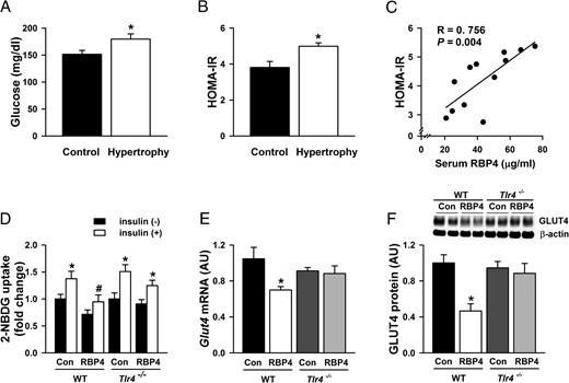 RBP4 and insulin resistance in cardiac hypertrophy. Serum glucose levels (A); HOMA-IR (B); and correlation of serum RBP4 with HOMA-IR (C) in Ang-II-induced cardiac hypertrophy and controls (n = 6 per group). *, P < .05 vs control. D, Insulin-stimulated glucose uptake in primary cardiomyocytes isolated from Tlr4 knockout (Tlr4−/−) or WT mice. RBP4-treated cardiomyocytes were stimulated with 2-NBDG together with or without insulin (100 nM) for 30 minutes (n = 8 per group). *, P < .05 vs no insulin in each group; #, P < .05 vs control with insulin stimulation in WT mice. E and F, Glut4 mRNA expression (E) and GLUT4 protein levels (F) in cardiomyocytes treated with or without RBP4 in Tlr4−/− and WT mice (n = 6 per group). *, P < .05 vs control in WT mice. AU, arbitrary units.