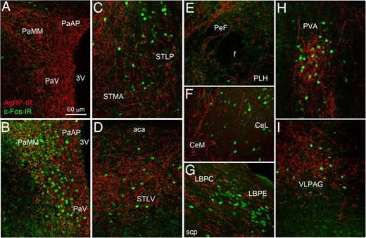 Dual-label immunofluorescence for c-Fos (green) and AgRP (red) in the mouse brain (confocal microscopy). A, In a saline-treated mouse, c-Fos labeling was minimal. All of the other images are from LPS-treated animals. B–I, In response to LPS (2-h time point), c-Fos accumulated in areas highly innervated by AgRP-positive fibers. 3v, third ventricle; aca, anterior part of anterior commissure; CeL, lateral division of the CeA nucleus; CeM, medial division of the CeA nucleus; f, fornix; LBPC, central part of the lateral parabrachial nucleus; LBPE, external part of the lateral parabrachial nucleus; PaAP, anterior parvicellular part of the PVH; PaMM, medial magnocellular part of the PVH; PaV, ventral part of the PVH; PeF, perifornical area; PLH, peduncular part of the LHA; PVA, anterior part of the paraventricular thalamus; scp, superior cerebellar peduncle; STMA, anterior part of the lateral division of the bed nucleus of the ST; STLP, posterior part of the medial division of the bed nucleus of the ST; STLV, ventral part of the lateral division of the bed nucleus of the ST; VLPAG, ventrolateral part of the periaqueductal gray.