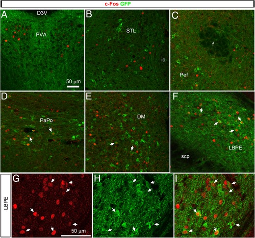Distribution of c-Fos (Alexa Fluor 594) and GFP immunoreactivity (Alexa Fluor 488) in representative brain sites of MC4R-GFP mice treated with LPS (confocal microscopy). Images from A to F are z-stacks of about 20 optical sections taken with a ×40 objective. Images from G to I were taken with a ×63 objective and are representative of the LPBE. White arrows indicate cells with evident colocalization between c-Fos and GFP. PaPo, posterior part of the paraventricular nucleus of the hypothalamus; PeF, perifornical area. Other abbreviations can be found in Figures 1 and 2.