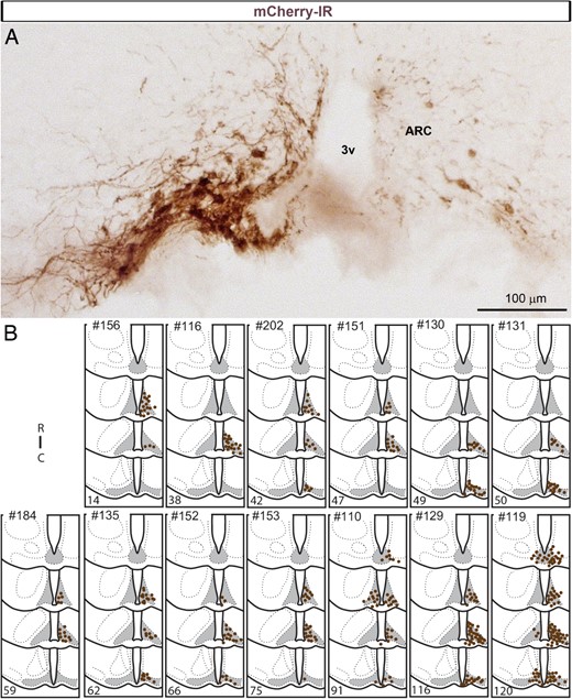A, Expression of mCherry (brightfield illumination) detected with IHC in 1 successful injection of AAV8-hM3D-Gq-mCherry. Immunoreactivity is observed in the somas and proximate dendrites of neurons at the site of injection but not in the surrounding structures. A few DAB-labeled neurons were also seen on the contralateral side of the injection, presumably due to the diffusion of viral particles via the median eminence. B, Camera lucida drawings of 4 rostral-to-caudal levels of the mouse hypothalamus illustrate the distribution of cells positive for mCherry in the ARC of 13 successful cases (AgRP-Cre mice). Each dot represents 2 positive cells. Numbers in the bottom left corner of each case correspond to the number of positive cells counted in a 1:5 series of brains sections. Note that the number of mCherry-positive neurons and their rostrocaudal distribution vary between animals. 3v, third ventricle; C, caudal; IR, immunoreactivity; R, rostral