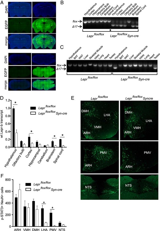 Leprflox/flox Syn-cre mice have disrupted neuronal leptin signaling outside the ARH and VMH. A, Representative images of EGFP immunoreactivity in coronal sections from R26mTmG/+Syn-cre mice (right panels) and R26mTmG/+ controls (left panels) demonstrate widespread Syn-cre-induced recombination in anatomically matched sections at the level of the arcuate nucleus (upper panels) and the NTS (lower panels). Representative images of recombination of Leprflox allele in indicated CNS regions (B) and peripheral tissues (C; with hypothalamus included for comparison), assessed by PCR of genomic DNA from male Leprflox/flox Syn-cre and Leprflox/flox male littermates, using primers mLepr101 and mLepr102. D, Abundance of wild-type (wt) Lepr-b cDNA in CNS regions of 8-week-old Leprflox/flox Syn-cre (n = 5) and Leprflox/flox (n = 4) male mice, assessed by quantitative RT-PCR with LeprE17 primers and expressed relative to Leprflox/flox hypothalamus. E, Representative images of p-STAT3 staining in hypothalamic nuclei (ARH, VMH, DMH, and LHA, top panels; ARH and PMV, middle panels; NTS lower panels) in brain sections from 10-week-old Leprflox/flox Syn-cre (n = 4) male mice and Leprflox/flox littermate (n = 3) controls, 45 minutes after injection of 2 μg/g leptin or vehicle, quantified in panel F. *, P < .05 between genotypes via Student's t test corrected for repeated measures.