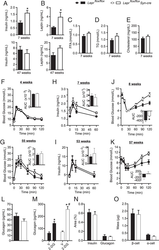 Leprflox/flox Syn-cre male mice are hyperinsulinemic and hyperleptinemic. Four-hour fasted plasma insulin (A), leptin (B), triglyceride (TG; C), free fatty acid (FFA; D), and cholesterol (E) levels were measured in Leprflox/flox Syn-cre (white) and Leprflox/flox (black) male mice at the ages indicated. Oral glucose tolerance tests were performed at 4 weeks (F) and 55 weeks (G) of age, AUC inset. Glucose-stimulated plasma insulin levels were measured at 7 (H) and 53 weeks (I) of age, AUC from baseline inset. Insulin tolerance tests were performed at 8 weeks (J) and 57 weeks (K) of age, net AUC from baseline inset. Overnight-fasted plasma glucagon levels in 8-week-old males (L). Plasma glucagon levels 15 minutes after an ip injection of 250 mg/kg 2-deoxyglucose (2-DG) or vehicle (V) in overnight-fasted 8-week-old mice (M). Insulin- and glucagon-positive area (N) and β-cell and α-cell mass (O) were assessed in 8-week-old Leprflox/flox Syn-cre and Leprflox/flox male mice. Statistical analyses were performed by Student's t test (n = 5–8; A–L) or two-way ANOVA with Holm-Sidak post hoc testing (n = 4–5; M–O). *, P < .05 between genotypes; #, P < .05 between V and 2-DG-injected groups of same genotype.