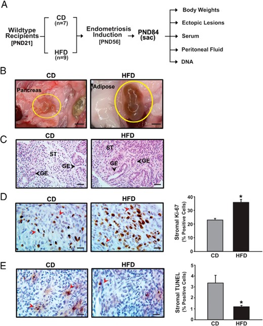 Experimental design and characterization of endometrial-like lesions derived from mice fed CD or HFD. A, Schematic representation of the generation of endometrial ectopic lesions in mice and their analyses. Klf9 WT mice were used as recipients of endometrial fragments from Klf9 null mice (donors), as previously described (28), with the indicated numbers of mice used for each diet group. B, Representative bright-field images of ectopic lesions isolated from WT recipients assigned to either CD or HFD groups, 4 weeks after ip administration of Klf9 null endometrium. Scale bar, 1 mm. C, H&E-stained sections of representative CD or HFD lesions at ×400 magnification. Scale bar, 20 μm. D, Representative sections of CD or HFD ectopic lesions showing Ki-67-positive stromal cells. E, Representative sections of CD or HFD ectopic lesions showing TUNEL-positive stromal cells. Red arrows indicate Ki-67-positive (D) and TUNEL staining (E) stromal cells. Four lesions per dietary group, each representing an individual mouse, were analyzed. Scale bar, 20 μm. For D and E, the percentages of staining cells (expressed as mean ± SEM) were quantified by counting the number of immunopositive nuclei over the total number of stromal cells per field and are presented as bar graphs; *, P < .05 by Student's t test.